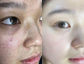 Làn Da Khỏe Đẹp Cùng Mỹ Viện Hoàng Gia – Chăm Sóc Da Uy Tín Tại Thủ Đức