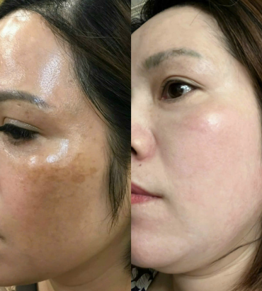 XOÁ NÁM THỦ ĐỨC